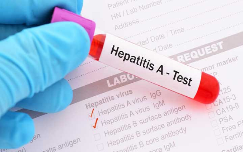 Hình minh hoạ Xét Nghiệm Test Nhanh Viên Gan A