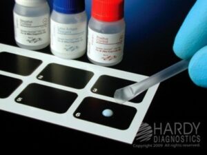 Hình minh hoạ Xét Nghiệm Aslo Định Tính