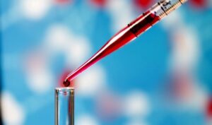 Hình minh hoạ Xét Nghiệm Immunoglobulin E (Ige)