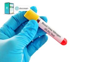 Ảnh minh hoạ bài viết Xét Nghiệm Định Lượng Ure Máu