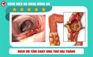 Cơ sở tầm soát ung thư đại tràng tốt nhất hà tĩnh