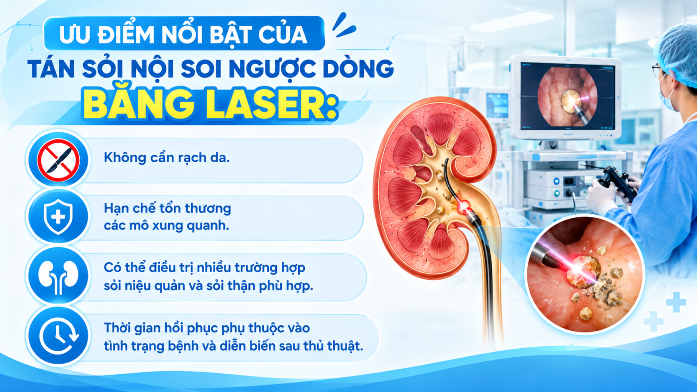 Ưu điểm của phương pháp tán sỏi nội soi ngược dòng bằng Laser